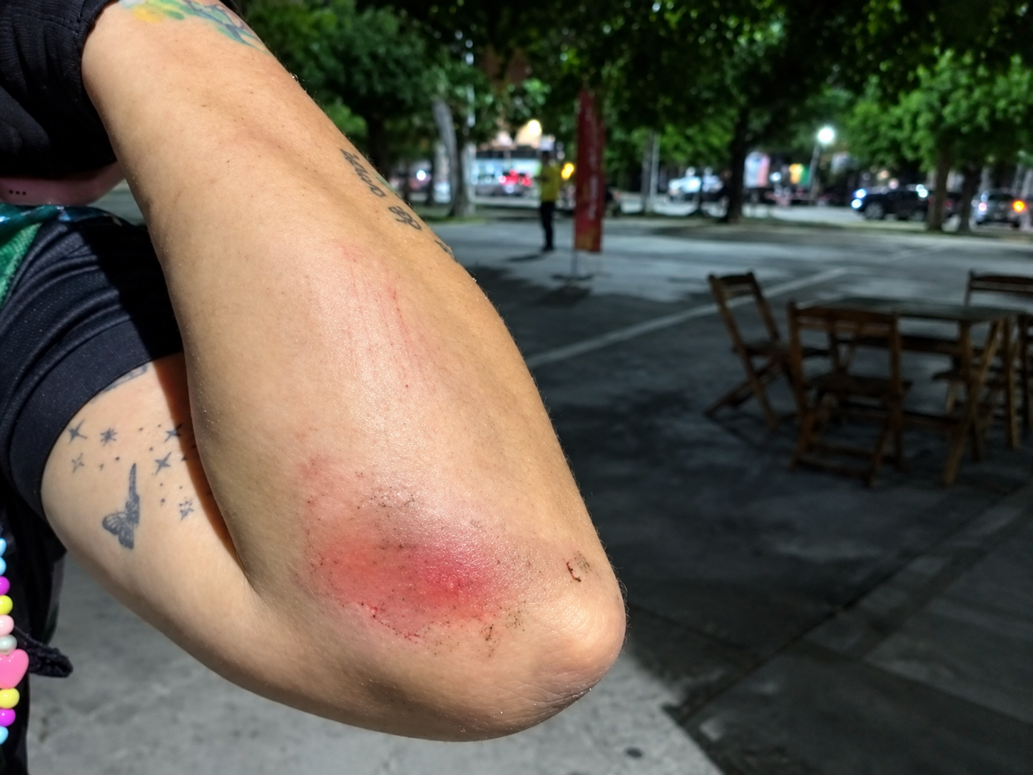 Professora cai de bicicleta após bandeira eleitoral atingir guidão em ciclofaixa de Fortaleza